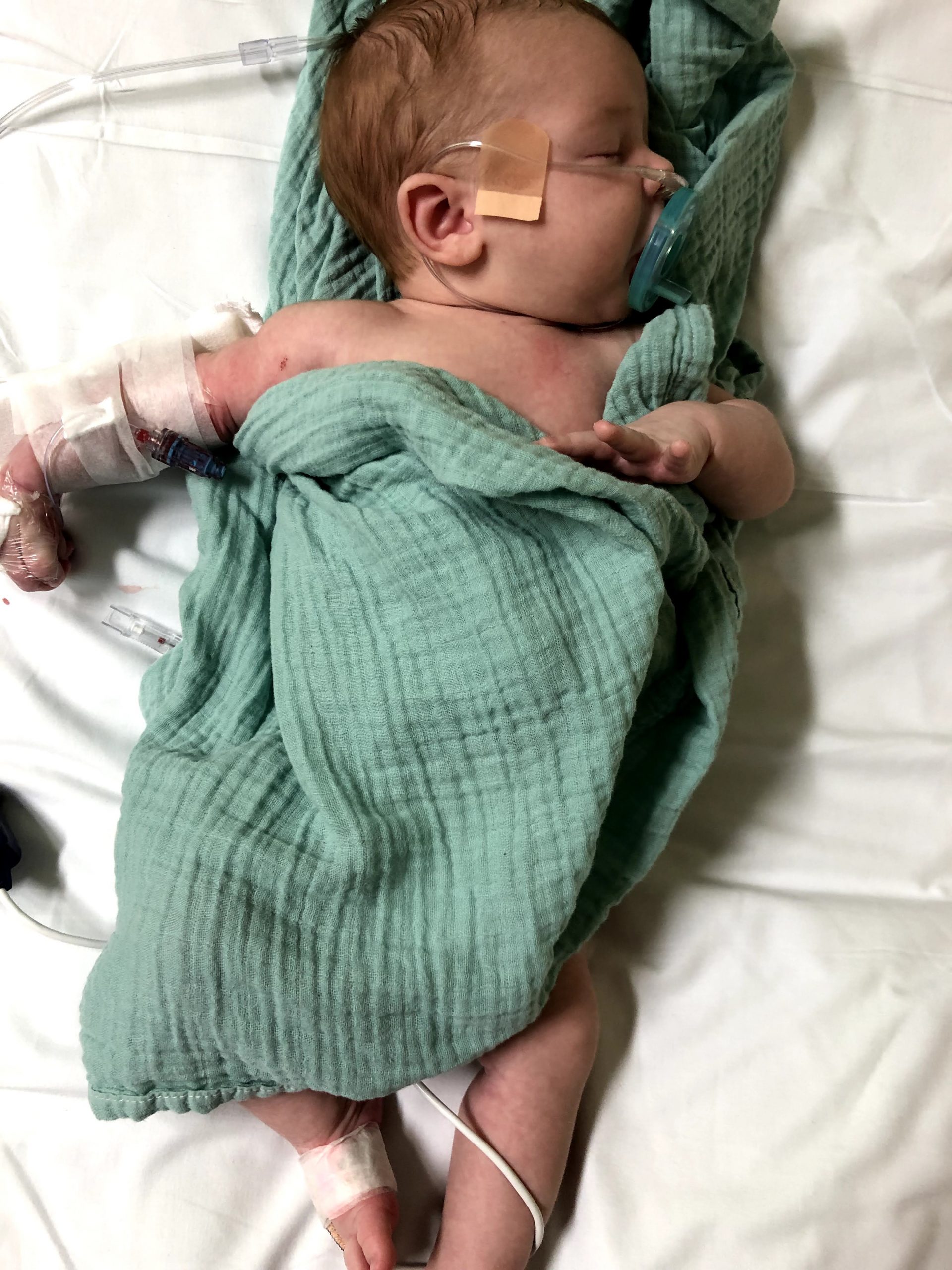 Where to go to the ER in Lafayette Louisiana with a newborn?