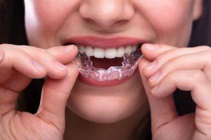 Why Is My Child Grinding Their Teeth At Night? What can I do about teeth grinding?