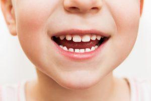 Why Do Baby Teeth Matter?