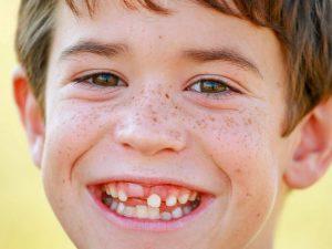 Why Do Baby Teeth Matter?